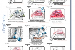 037V Storyboards for Nasonex Animation