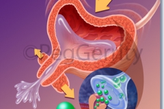 Overactive Bladder (Image 355R)