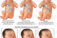 202V-Newborn-Assessments