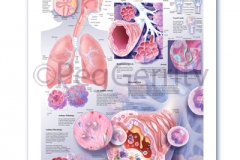 Asthma Poster 416