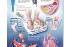 Obesity Poster 447