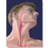 Carotid-Artery-013