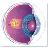 063-Macular-Degeneration-1