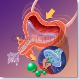 Overactive Bladder (Image 355R)