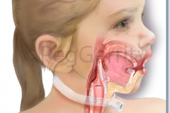 332ML-Ingested-Toxins-A