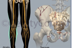 CMG-01-Car-Wreck-S1-Injury-A