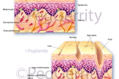 177 Aged Skin vs Young Skin