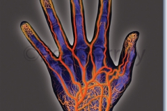 Arteriogram-of-Hand-and-Arm-297