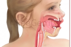 332R-Healthy-Nasopharynx-Child